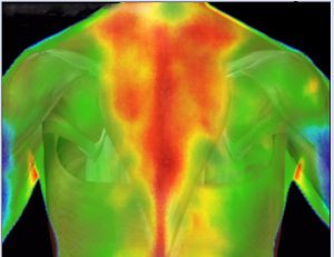 Medical Thermography Research Imaging Upper Back Pain Holistic Integrated Healthcare Natural Medicine Center Lakeland Central Florida