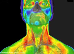 Medical Thermography Research Thyroid Holistic Healtcare Natural Medicine Center Lakeland Central Florida